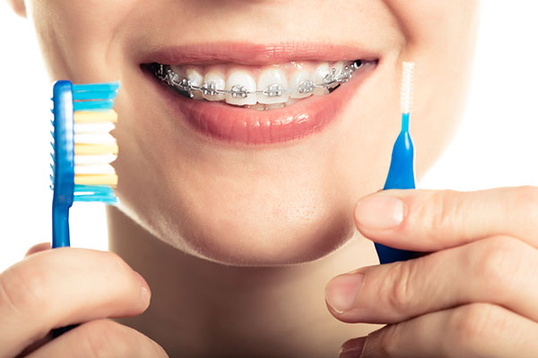 Teeth Straightening FAQs: Why Should I Straighten My Teeth?