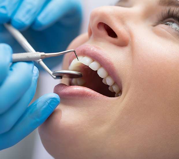 Lilburn Dental Bonding