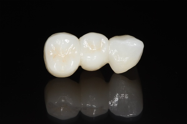 How To Tell If You Are A Candidate For A Dental Bridge