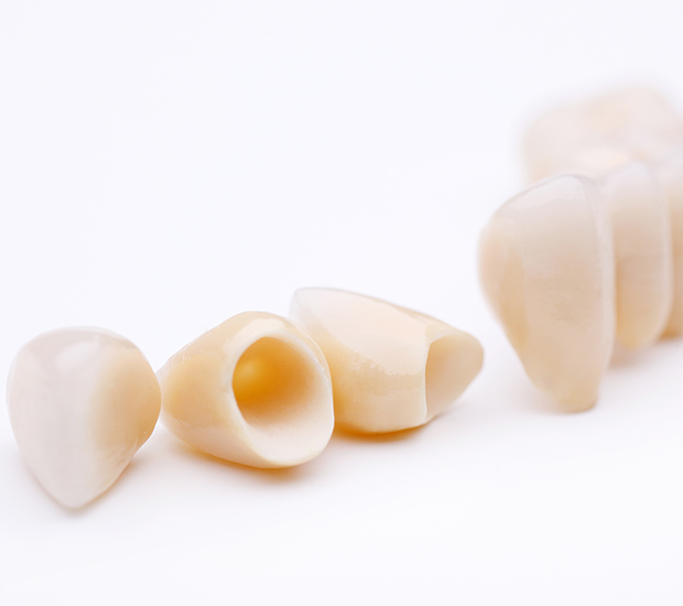 Lilburn Dental Crowns and Dental Bridges