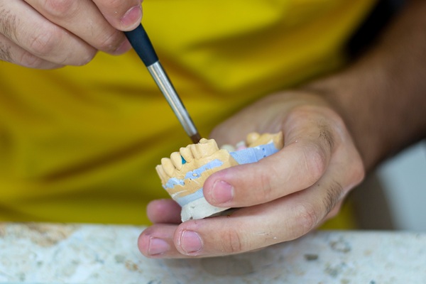 The Different Types Of Dental Implant Restorations