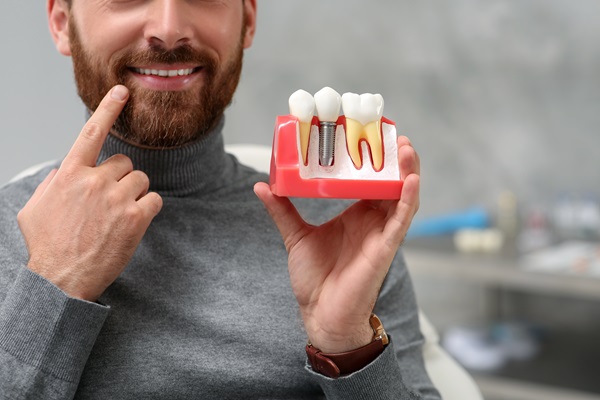 Dental Implants And Bridges To Replace Multiple Missing Teeth