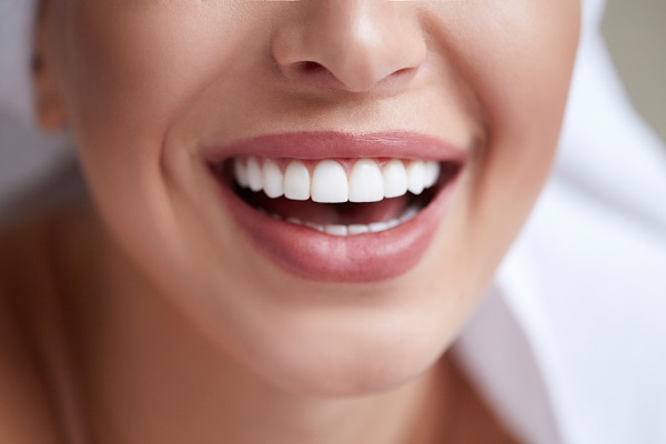 When Would A Dentist Recommend Dental Laminates?