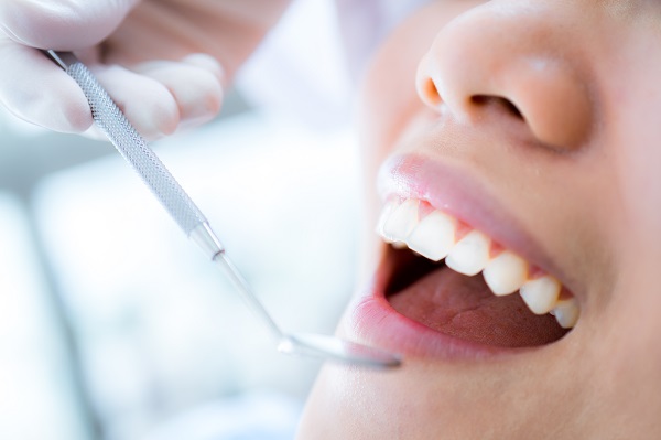 A Step By Step Guide To The Dental Sealants Process