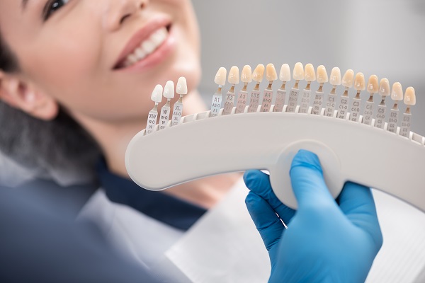 Prepping Your Teeth For Dental Veneers