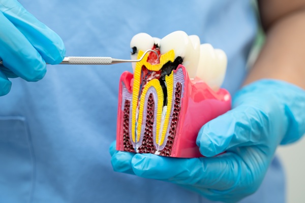 From Pain To Relief: Journey Through Endodontics With A Gentle Dentist