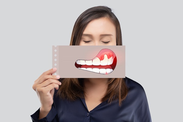 What You Should Know About Gum Disease