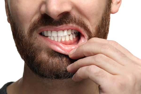 The Root Cause Of Gum Disease And How To Treat It