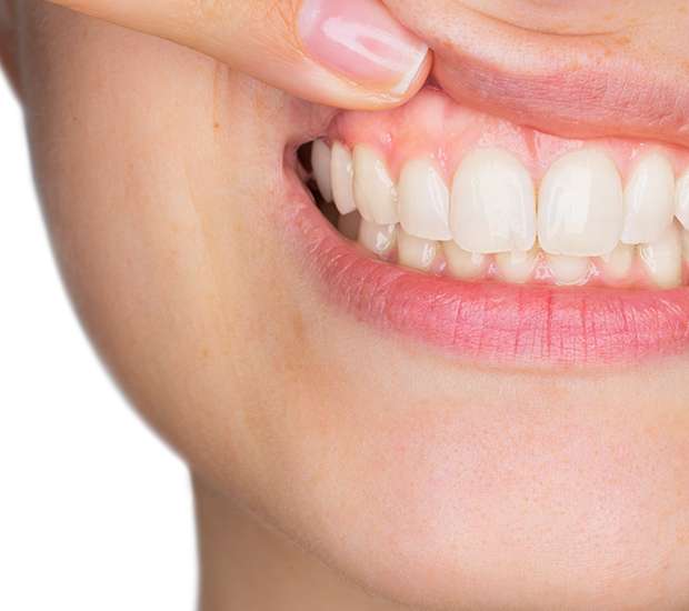 Lilburn Gum Disease