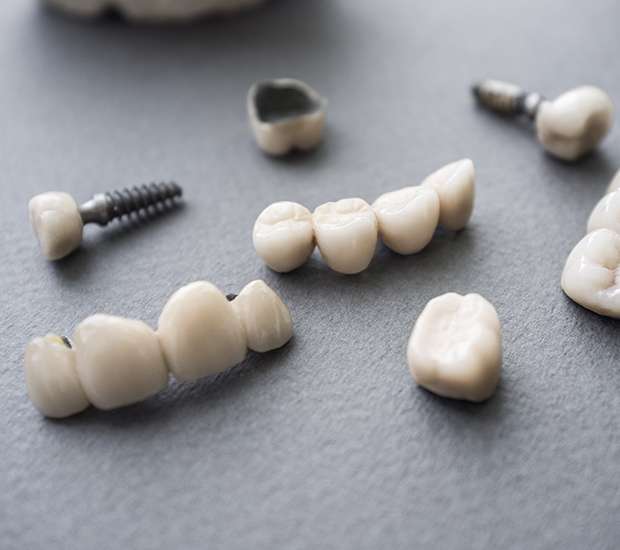 Lilburn The Difference Between Dental Implants and Mini Dental Implants