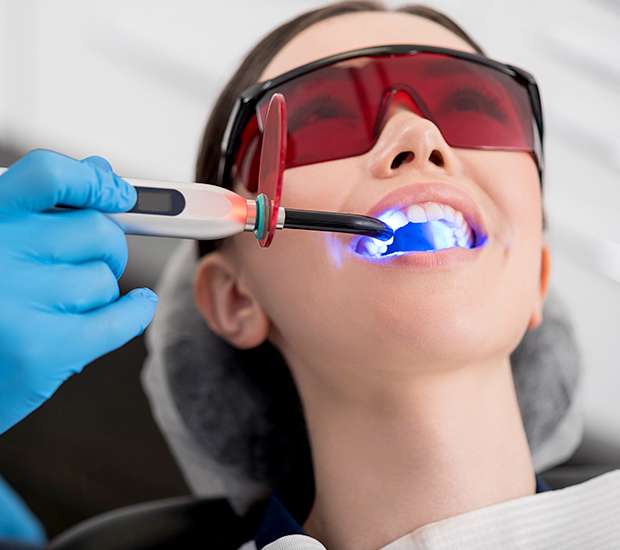 Lilburn Professional Teeth Whitening