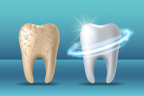 Pros and Cons of Teeth Whitening Treatments from Lilburn Family Dentistry in Lilburn, GA